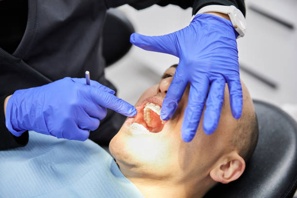 Best Emergency Dentist for Lost Fillings or Crowns in Pleasanton, CA